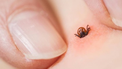 老人离世，儿子睡其生前床上确诊同症！医生：蜱虫病毒引发“母子同病”